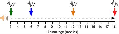 Age-Related Hearing Loss Is Accelerated by Repeated Short-Duration Loud Sound Stimulation